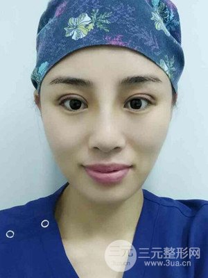 青海康华马晶医生给我做的硅胶假体隆鼻+双眼皮手术，分享一下前后对比图