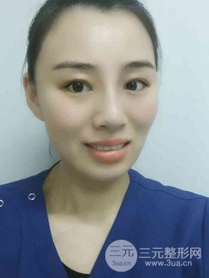 青海康华马晶医生给我做的硅胶假体隆鼻+双眼皮手术，分享一下前后对比图