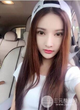 我的埋埋蛋白线.提升日记：真实案例——潍坊华美童艳梅医生做的