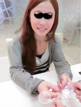 埋埋蛋白线.提升真实案例分享：汕头爱丽诺时慧医生做的