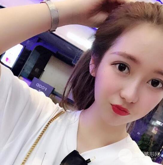 长得太着急是怎样一种体验？妹子血泪分享自体脂肪填充详细部年轻化经验