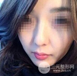 汕头伊丽莎白张红军给我打的B****，分享一下前后照片