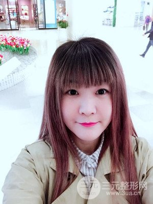 做了自体脂肪填充全脸日记分享——汕头伊丽莎白孙杰医生做的