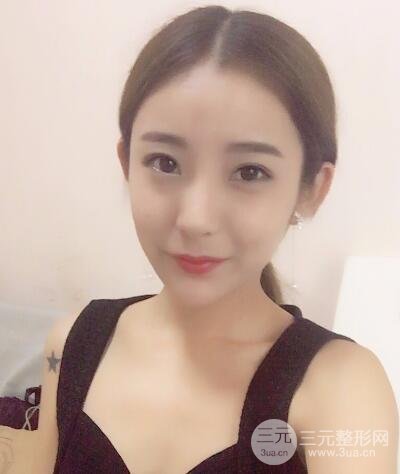 注射玻尿酸注射除皱紧致肌肤前后对比图案例