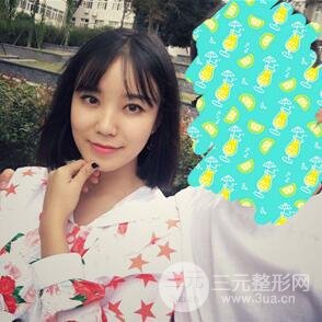 双眼皮+开内眼角手术前后对比图片，真实案例