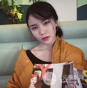 双眼皮+开内眼角手术前后对比图片，真实案例