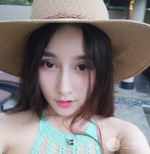 深圳源美做隆鼻失败修复价格案例