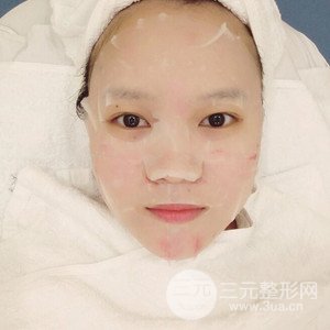 注射水光补水案例——襄阳维多利亚聂立敏医生做的