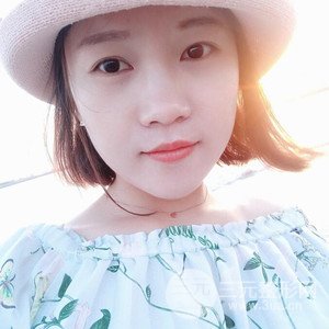 注射水光补水案例——襄阳维多利亚聂立敏医生做的