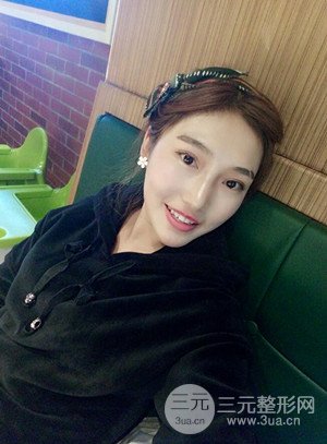 激光脱毛前后照片分享，真实案例~