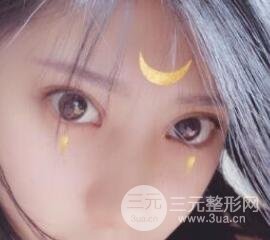 成都娇点李竞割双眼皮价格和案例