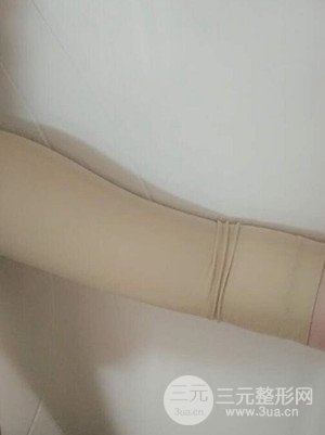 武汉天申朱天申医生做的水动力吸脂瘦手臂，真实案例并附上前后对比图