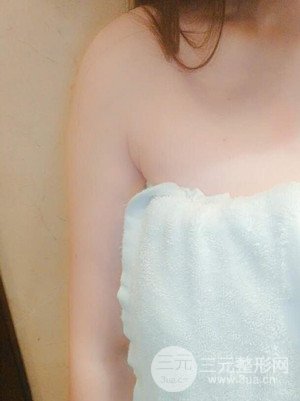 武汉天申朱天申医生做的水动力吸脂瘦手臂，真实案例并附上前后对比图