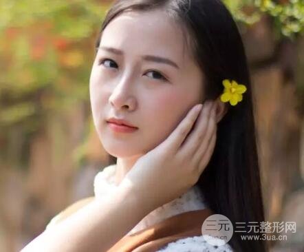 武汉天申朱天申切开双眼皮真实案例，附上前后对比图片