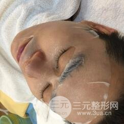 男士高强度聚焦超声面b提升微整形真实案例