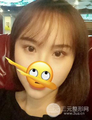 武汉天申胡丽医生发际线种植真实案例，并附上前后对比图片