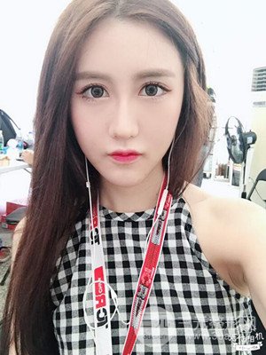 武汉一美汪国民医生做的面部吸脂【案例】，分享一下前后对比图片