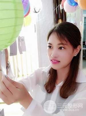 激光祛斑真实案例——武汉一美王朝辉医生做的