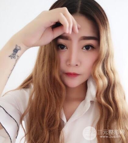 全切开双眼皮价格和恢复过程对比图片
