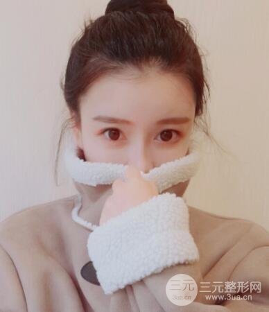 终于去做了全脸自体脂肪填充，果还是很不错的