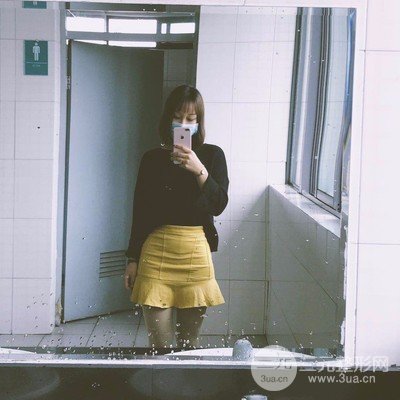 武汉美仑陈远海医生做的大腿吸脂案例，分享一下前后对比图