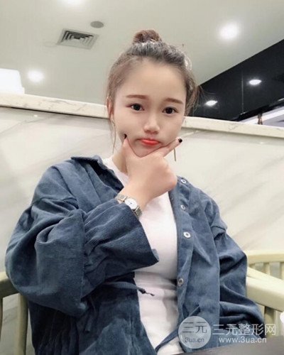 假体隆鼻前后果恢复对比过程图  论鼻子的重要性