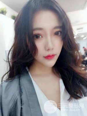 自体脂肪填充额头+丰下巴真实案例，昆明都市俪人金海坤医生做的