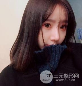 武汉希思特杨权明假体隆鼻案例日记真实记录分享