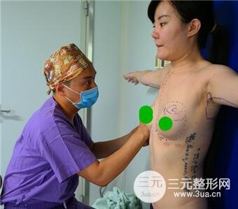 北京伟力嘉美信马永奇自体脂肪隆胸案例图片