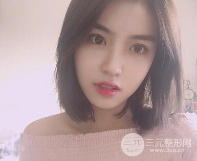 南京康美陈小剑做的双眼皮案例果真实的分享给你们！