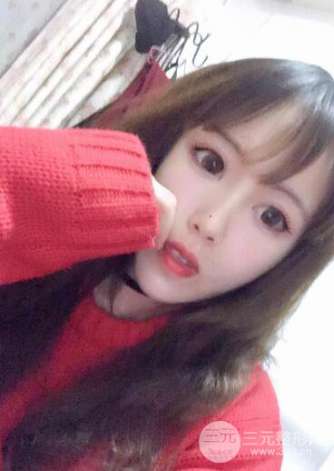 自体脂肪填充全脸基本换脸，改脸型不只是磨骨才能做到！