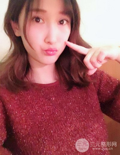 苏州美贝尔假体隆胸案例，对比图恢复过程分享~