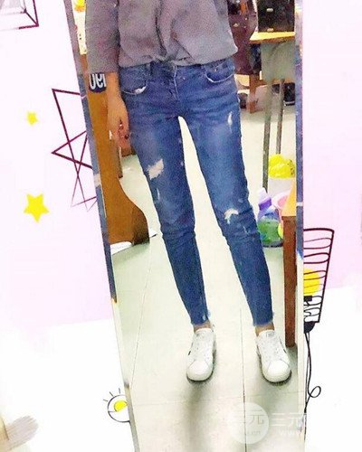 广州韩妃大腿吸脂案例，恢复过程前后对比图片分享~