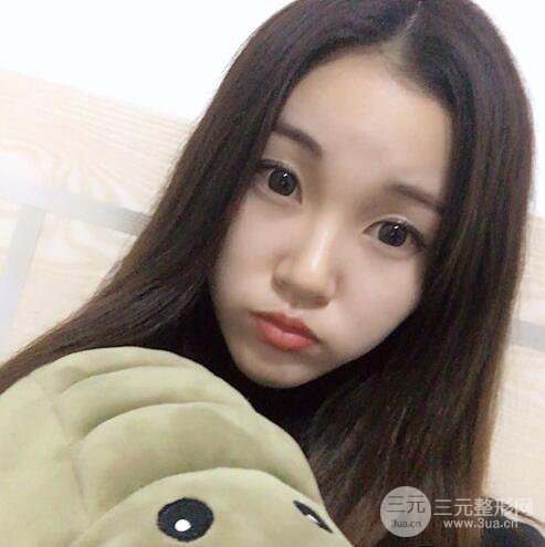 下颌角磨骨整形全过程分享，附上术后恢复照片~