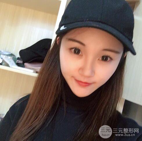 下颌角磨骨整形全过程分享，附上术后恢复照片~