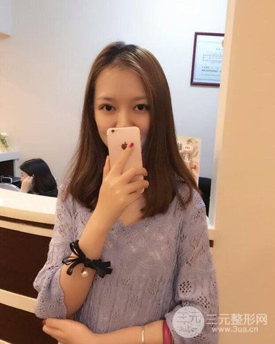 深圳蒳美迩黄海彬双眼皮案例恢复过程对比图分享~