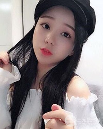 深圳蒳美迩朱灿医生眼隆鼻整形案例分享，附上前后对比照~