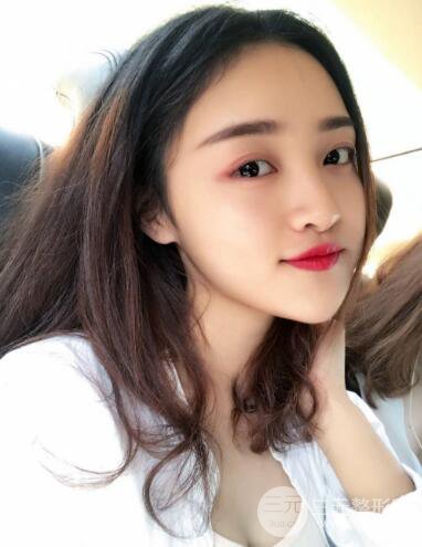 九院曹卫刚自体脂肪面部填充案例