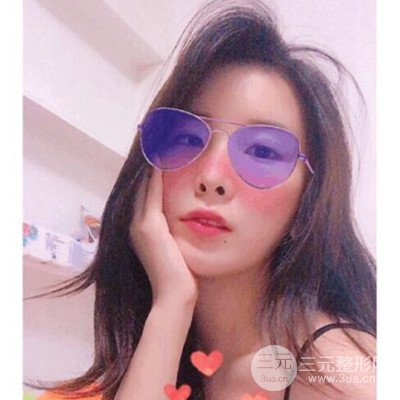 济南伊美尔整形王飏自体脂肪面部填充案例前后对比