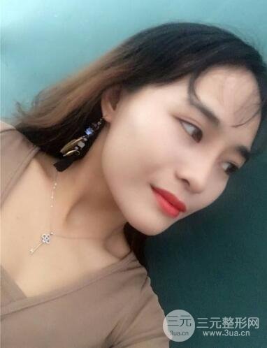 李青峰做隆鼻的风格|案例果图日记