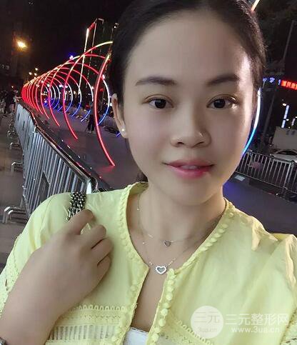 常州一院王德伟双眼皮恢复日记实记