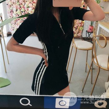 济南腰腹吸脂案例三个月前后变化图片分享