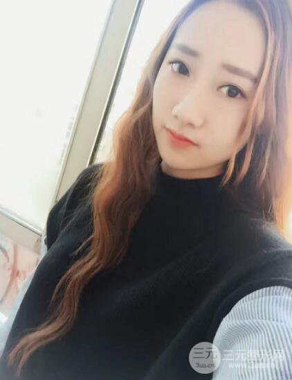 西安西美张丽双眼皮案例图片分享