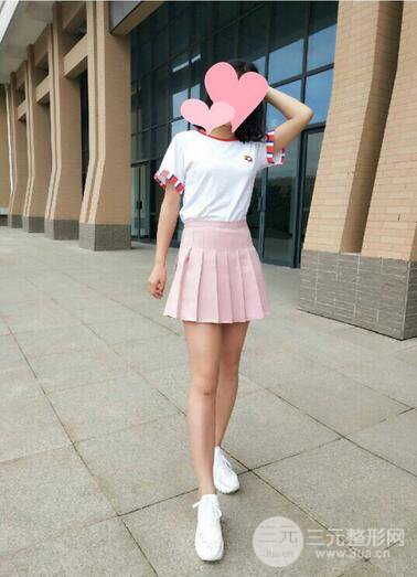 曹卫刚大腿吸脂案例恢复图片记录分享