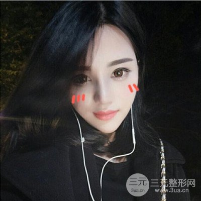 长沙亚韩整形医院郑京湘假体隆鼻案例对比实录