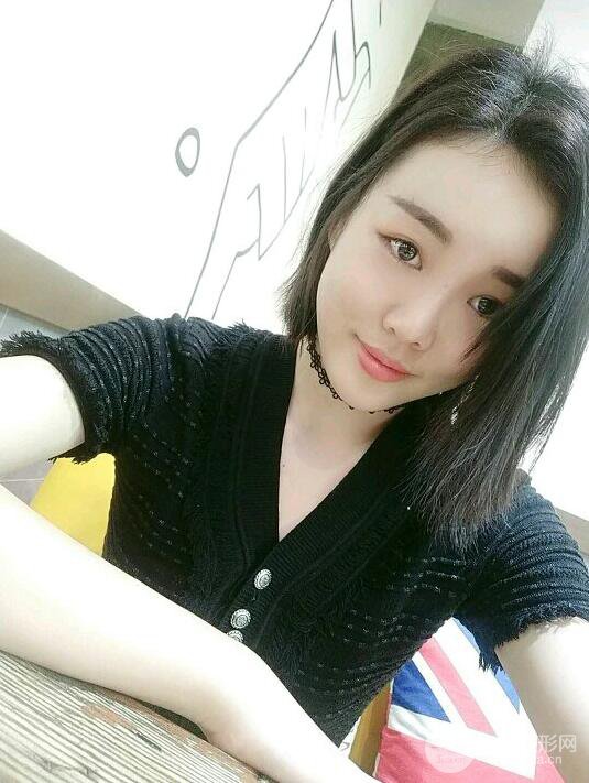 成都军大钟正强自体脂肪填充面部案例恢复图，马上变成“初恋脸”