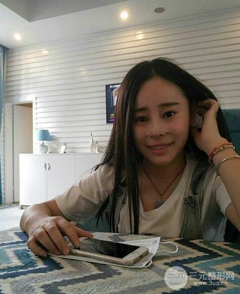 成都华颜贾德渊隆鼻失败修复真实案例分享，并且附上前后对比照片