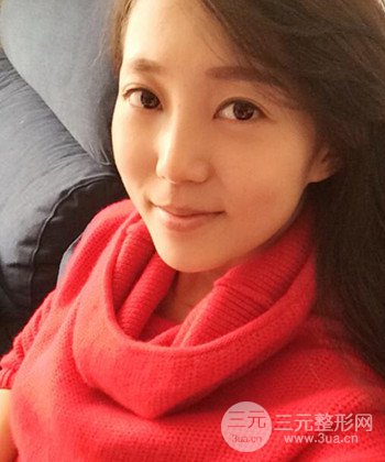 深圳内切去眼袋+硅胶垫下巴真实案例恢复果图