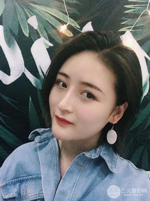 重庆五洲范文亮隆鼻整形案例，前后对比图分享