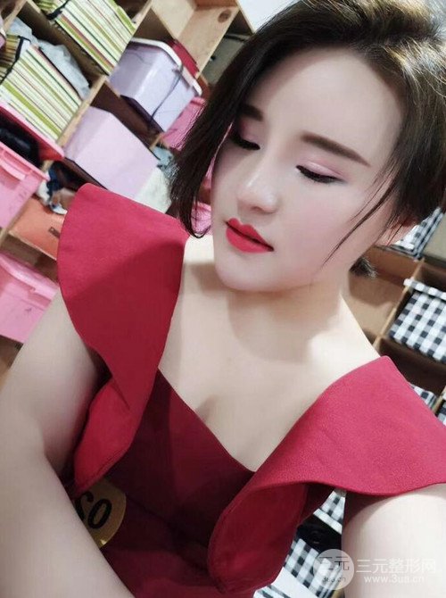 上海丽质吕成医生做的吸脂瘦脸日记，前后恢复图分享